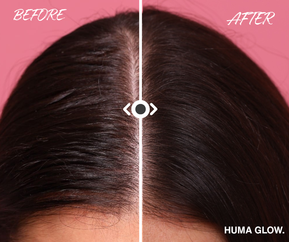Huma Glow сух шампоан - Image 3